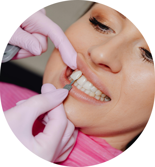 Pacient BluClinic zambind cu fatete dentare